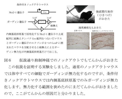 てんかんの原因の発見